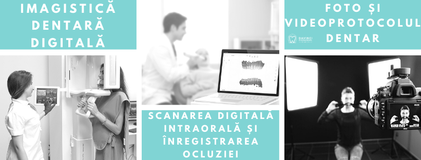 radiografie dentara, scanare digitala, stoamtologie digitala